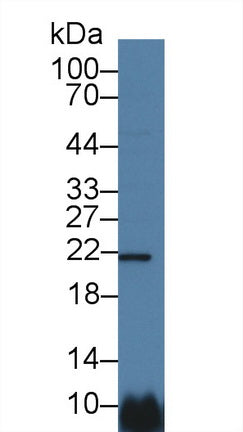 Western Blot; Sample: Recombinant protein.