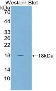 Used in DAB staining on fromalin fixed paraffin-embedded Kidney tissue