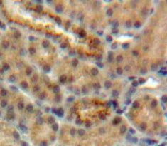Cystatin 5 (CST5) Polyclonal Antibody - image 4