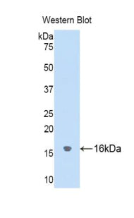 Cystatin 2 (CST2) Polyclonal Antibody - image 3