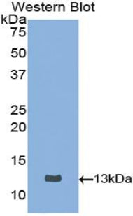 Western Blot; Sample: Lane1: Bovine Spleen lysate; Lane2: Human HepG2 cell lysate; Lane3: Human MCF-7 cell lysate; Primary Ab: 3µg/mL Rabbit Anti-Bovine CSTB Antibody; Second Ab: 0.2µg/mL HRP-Linked Caprine Anti-Rabbit IgG Polyclonal Antibody;