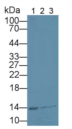 DAB staining on IHC-P; Samples: Bovine Kidney Tissue;  Primary Ab: 20µg/ml Rabbit Anti-Bovine CSTB Antibody Second Ab: 2µg/mL HRP-Linked Caprine Anti-Rabbit IgG Polyclonal Antibody