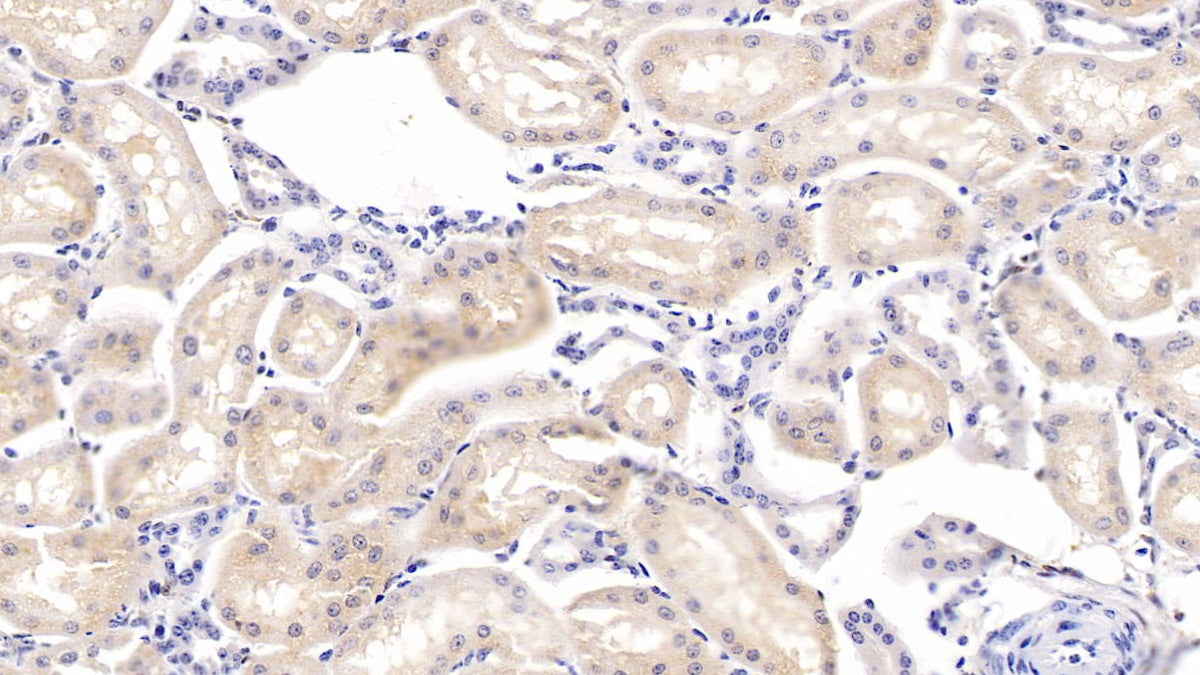 Cystatin B (CSTB) Polyclonal Antibody - image 4