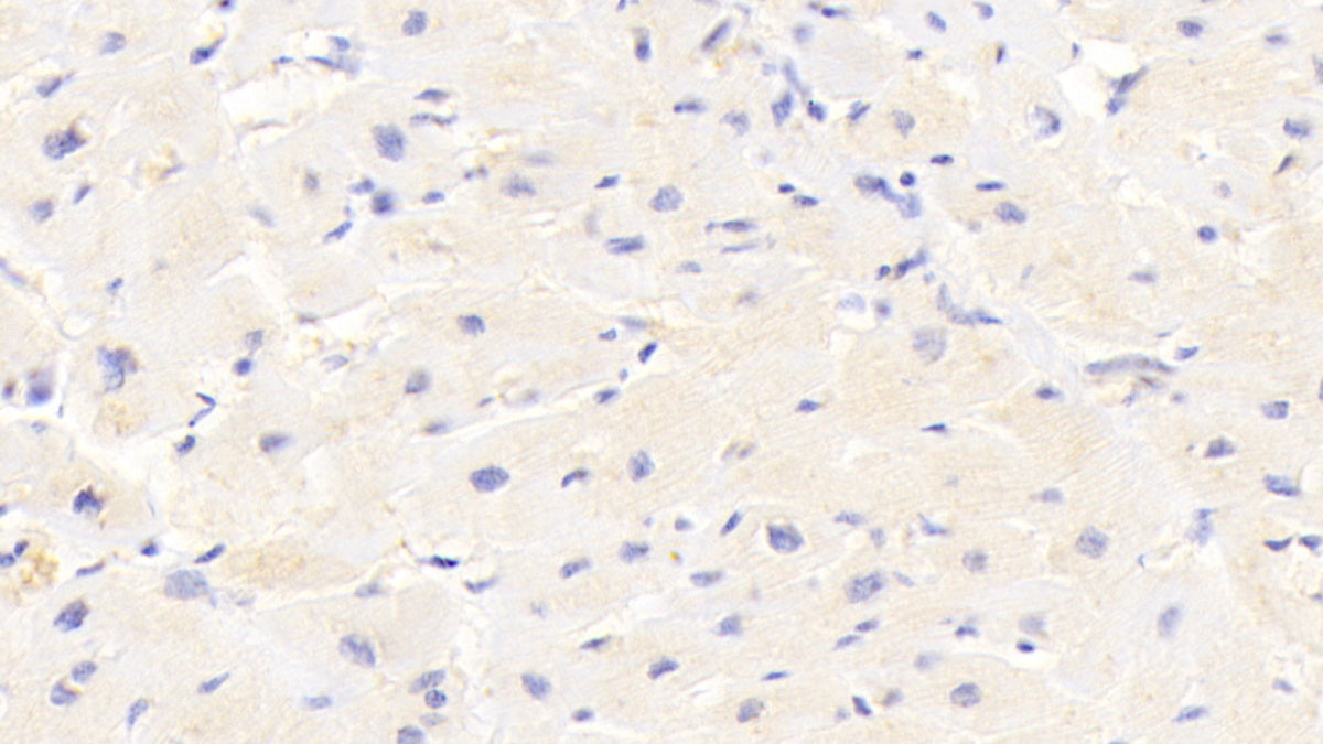 DAB staining on fromalin fixed paraffin- embedded Kidney tissue)