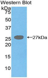 Diacylglycerol-O-Acyltransferase Homolog 1 (DGAT1) Polyclonal Antibody - image 2