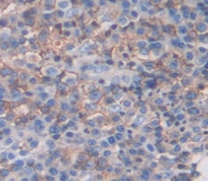 Diacylglycerol-O-Acyltransferase Homolog 1 (DGAT1) Polyclonal Antibody - image 3