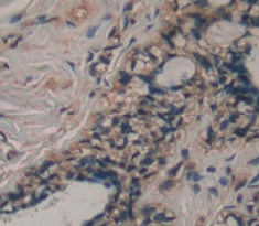 Diaphanous Homolog 1 (DIAPH1) Polyclonal Antibody - image 3