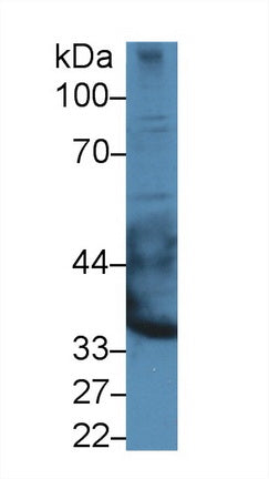 Western Blot; Sample: Recombinant protein.