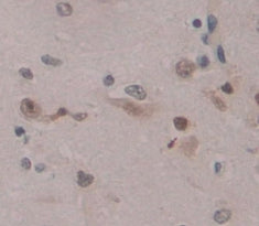E2F Transcription Factor 2 (E2F2) Polyclonal Antibody - image 3