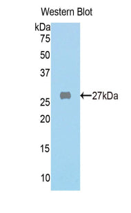 Fumarylacetoacetate Hydrolase (FAH) Polyclonal Antibody - image 2