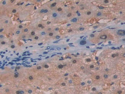 Fumarylacetoacetate Hydrolase (FAH) Polyclonal Antibody - image 4