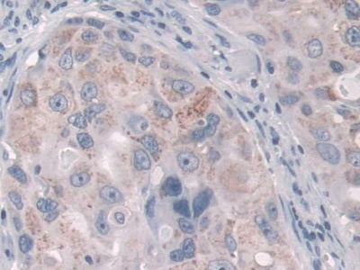 DAB staining on IHC-P; Samples: Human Liver Tissue;  Primary Ab: 10µg/ml Rabbit Anti-Human FcgRT Ant