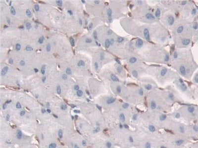 Fc Fragment Of IgG Receptor Transporter Alpha (FcgRT) Polyclonal Antibody - image 5