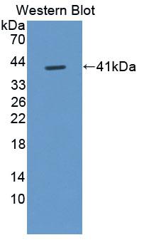 DAB staining on IHC-P; Samples: Human Kidney Tissue; Primary Ab: 20μg/ml Rabbit Anti-Human FIGN Antibody Second Ab: 2µg/mL HRP-Linked Caprine Anti-Rabbit IgG Polyclonal Antibody