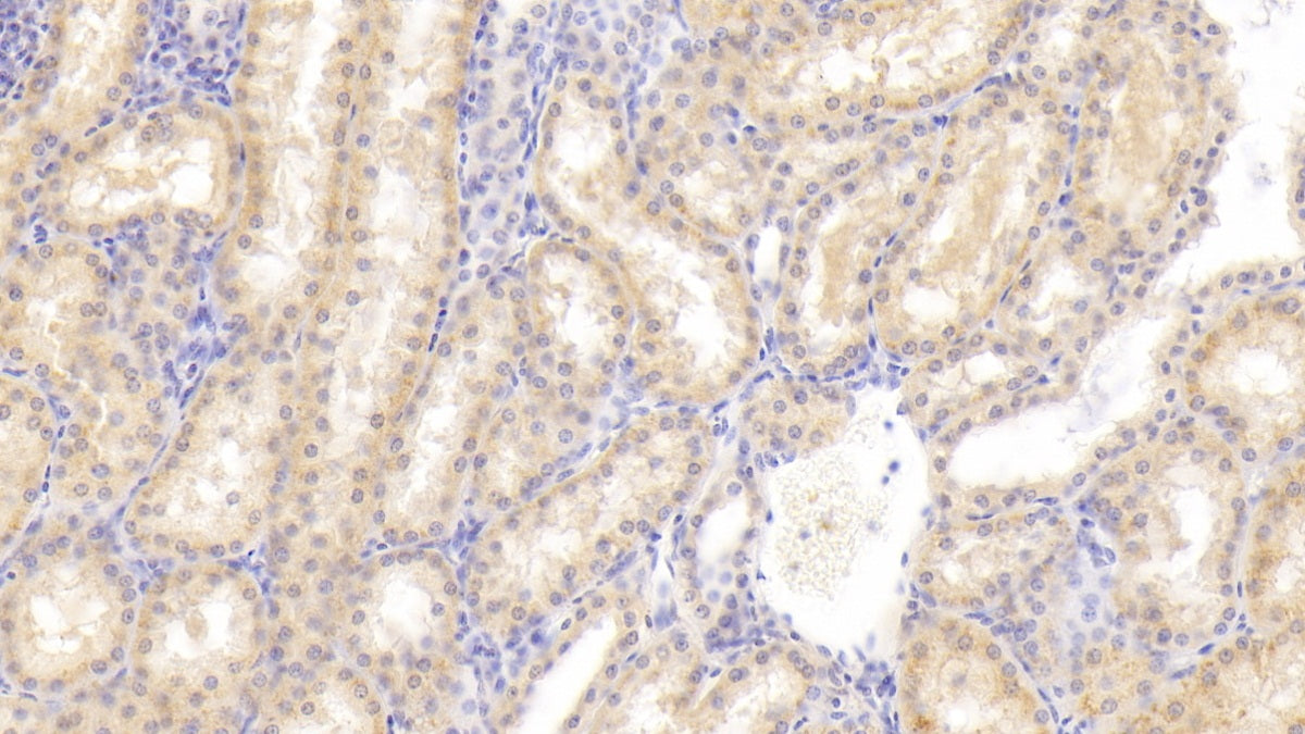 DAB staining on fromalin fixed paraffin-embedded liver tissue)