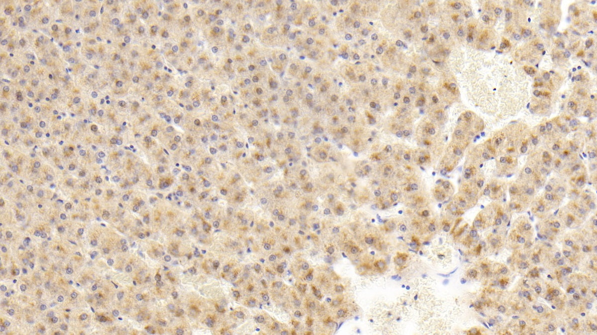 Fidgetin (FIGN) Polyclonal Antibody - image 5