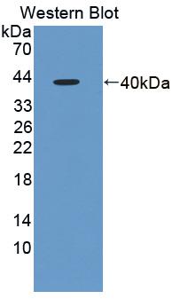 Fragile X Mental Retardation 1 (FMR1) Polyclonal Antibody - image 2