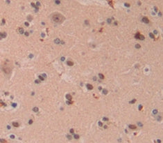 Fragile X Mental Retardation 1 (FMR1) Polyclonal Antibody - image 3