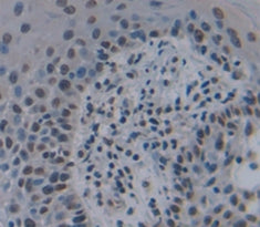 FOS Like Antigen 1 (FOSL1) Polyclonal Antibody - image 4