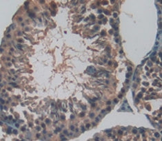 Fibrous Sheath Interacting Protein 1 (FSIP1) Polyclonal Antibody - image 3