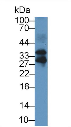 Western Blot; Sample: Recombinant protein.