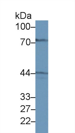 Western Blot; Sample: Recombinant protein.