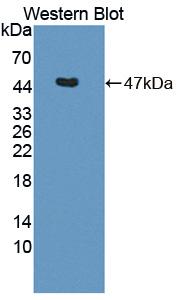 DAB staining on IHC-P; Samples: Rat Liver Tissue;  Primary Ab: 20μg/ml Rabbit Anti-Rat GALT Antibody Second Ab: 2µg/mL HRP-Linked Caprine Anti-Rabbit IgG Polyclonal Antibody