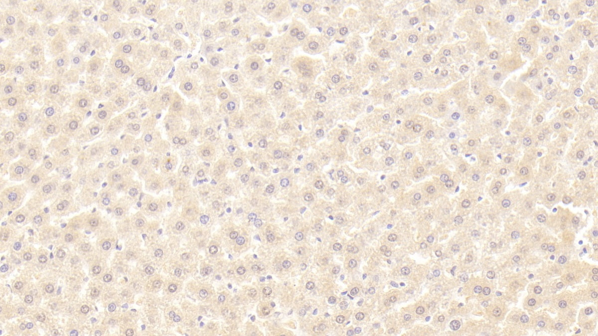 Galactose-1-Phosphate Uridylyltransferase (GALT) Polyclonal Antibody - image 4