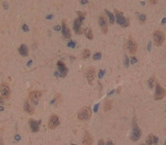 Huntingtin Associated Protein 1 (HAP1) Polyclonal Antibody - image 3
