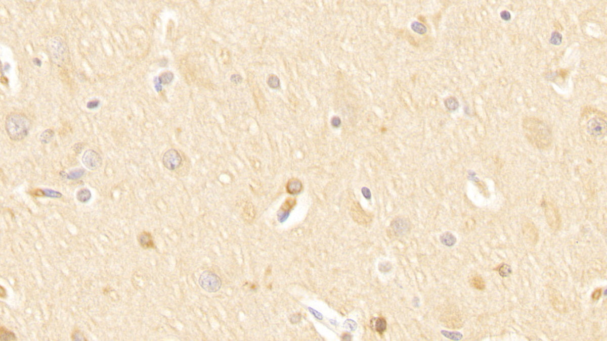 DABstainingonIHC-P.Samples:HumanTissue)