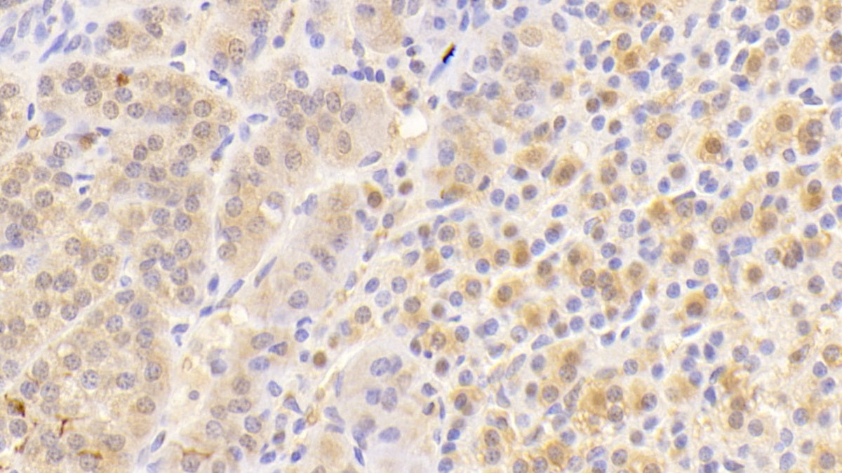 Huntingtin Associated Protein 1 (HAP1) Polyclonal Antibody - image 4
