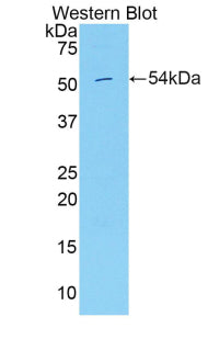 Hepatocyte Growth Factor Activator (HGFAC) Polyclonal Antibody - image 2