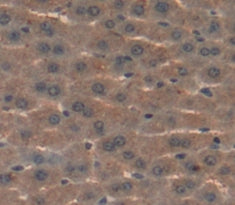 Hepatocyte Growth Factor Activator (HGFAC) Polyclonal Antibody - image 3