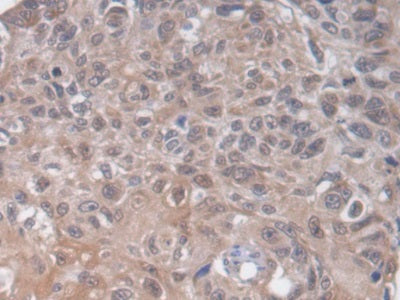 Heparan Sulfate-2-O-Sulfotransferase 1 (HS2ST1) Polyclonal Antibody - image 3