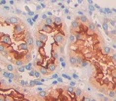 Heparan Sulfate-2-O-Sulfotransferase 1 (HS2ST1) Polyclonal Antibody - image 4