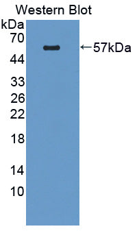 Pleckstrin Homology Domain Containing Family A, Member 1 (PLEKHA1) Polyclonal Antibody - image 2