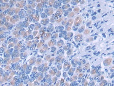 DAB staining on fromalin fixed paraffin- embedded Kidney tissue)