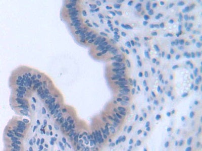 Pleckstrin Homology Domain Containing Family A, Member 1 (PLEKHA1) Polyclonal Antibody - image 4