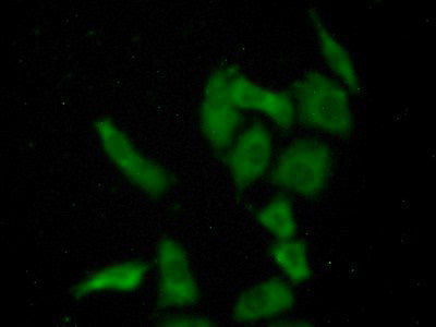 T-Box Protein 3 (TBX3) Polyclonal Antibody - image 4