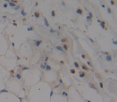 Zinc Ribbon Domain Containing Protein 1 (ZNRD1) Polyclonal Antibody - image 3