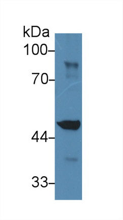 Western Blot; Sample: Recombinant protein.