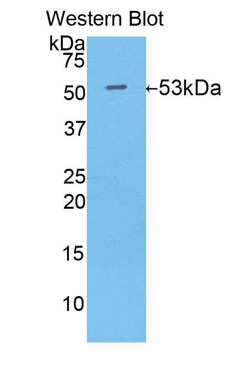 DAB staining on IHC-P; Samples: Mouse Kidney Tissue;  Primary Ab: 20μg/ml Rabbit Anti-Mouse IDH1 Antibody Second Ab: 2µg/mL HRP-Linked Caprine Anti-Rabbit IgG Polyclonal Antibody