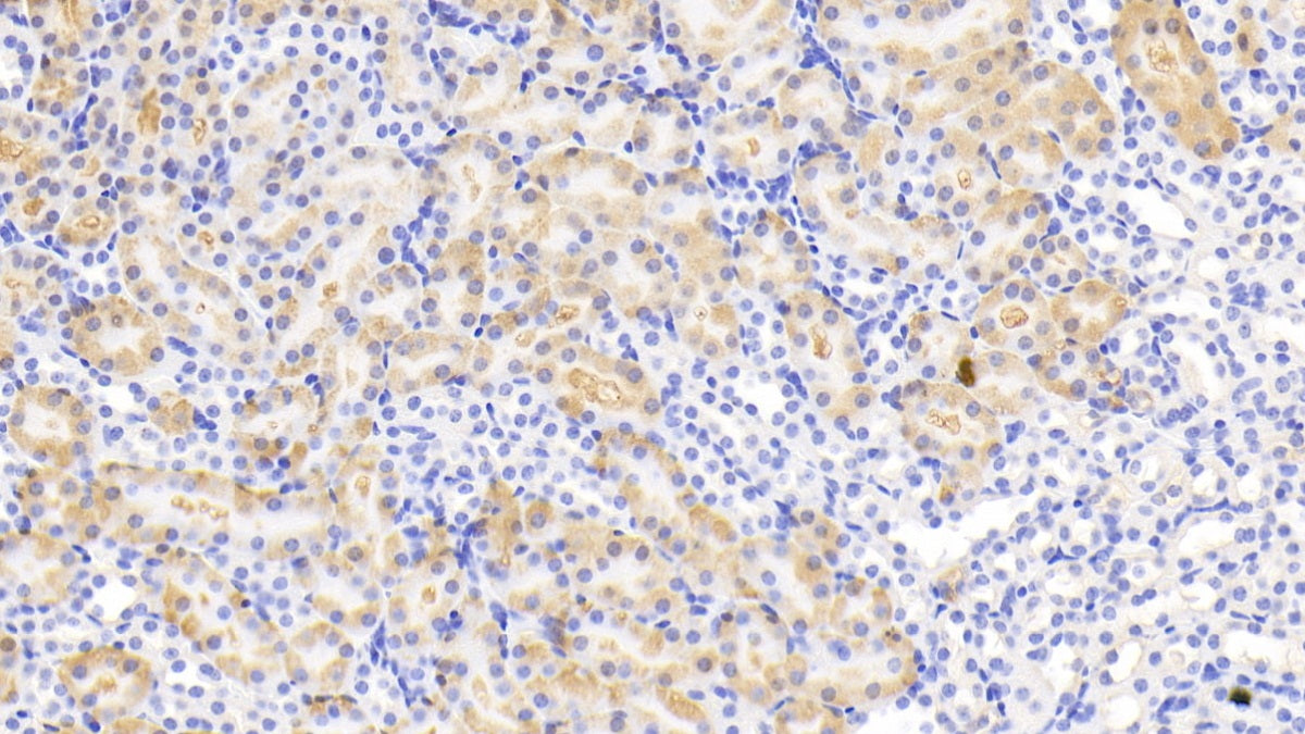 Isocitrate Dehydrogenase 1, Soluble (IDH1) Polyclonal Antibody - image 4