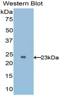 Interleukin 1 Receptor Like Protein 1 (IL1RL1) Polyclonal Antibody - image 3