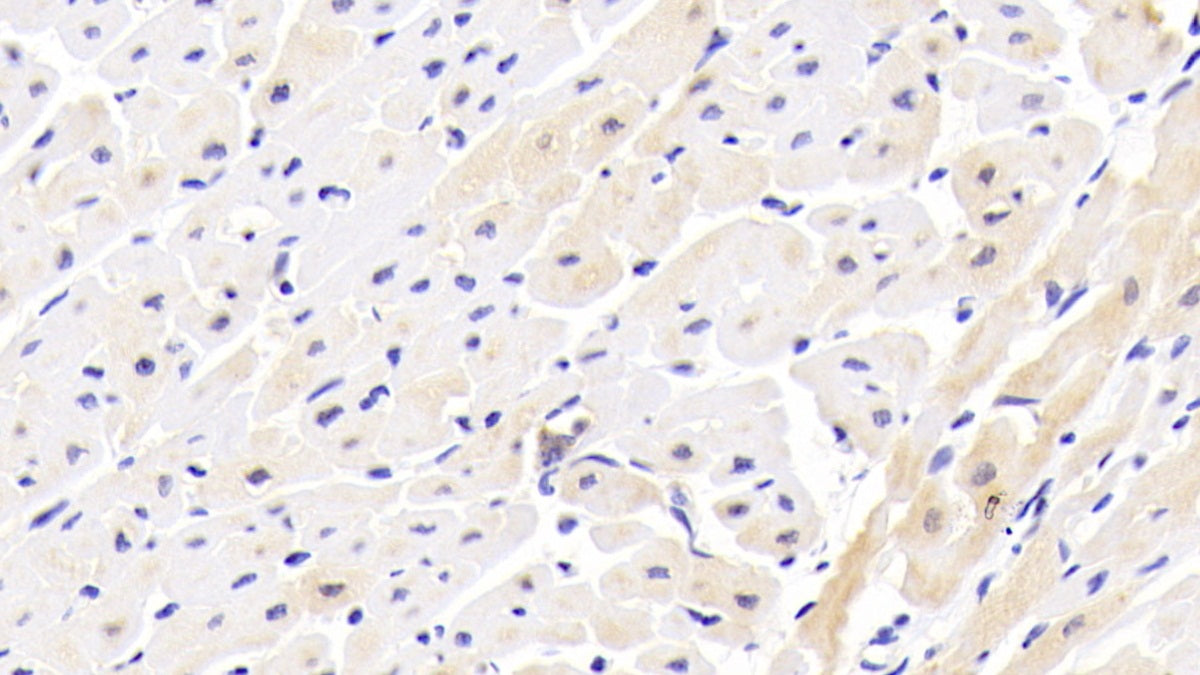 Interleukin 1 Receptor Accessory Protein Like Protein 1 (IL1RAPL1) Polyclonal Antibody - image 3