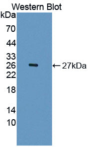 Interleukin 1 Receptor Accessory Protein Like Protein 2 (IL1RAPL2) Polyclonal Antibody - image 2