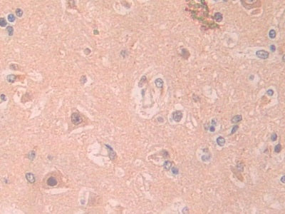DAB staining on IHC-P; Samples: Human Cerebrum Tissue)