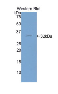 Inter Alpha-Globulin Inhibitor H1 (ITIH1) Polyclonal Antibody - image 2