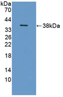 DAB staining on IHC-P; Samples: Human Breast cancer Tissue; Primary Ab: 10µg/ml Rabbit Anti-Human ITIH1 Antibody Second Ab: 2µg/mL HRP-Linked Caprine Anti-Rabbit IgG Polyclonal Antibody