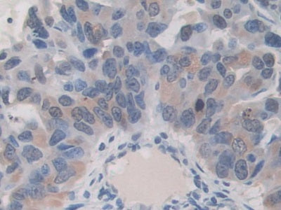 DAB staining on IHC-P; Samples: Human Prostate Gland Tissue.